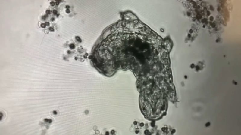 Tardigrades, the "indestructible" microscopic organisms