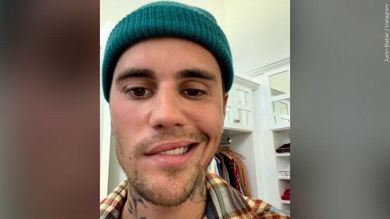 Justin Bieber revealed his facial paralysis in an Instagram video to his fans.